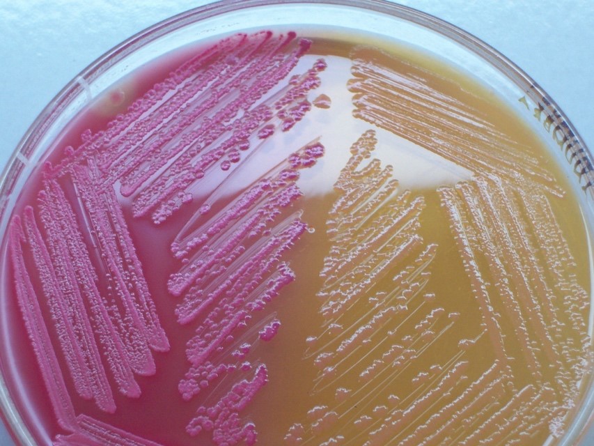 MAC plate with bright pink colonies on the left (lactose fermentors) and colorless colonies on the right (non-lactose fermentors)