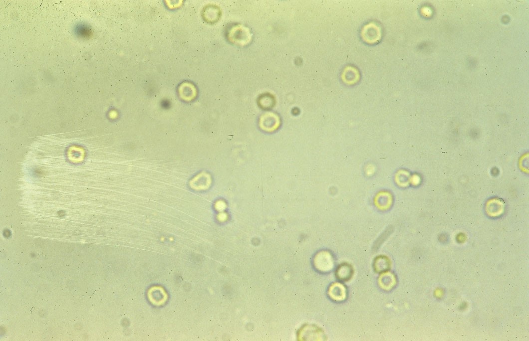 Many RBCs that display central pallor at 40x objective