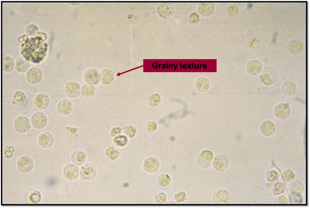 Module 8.4: Common Structures Observed On The Sediment Exam – Clinical 