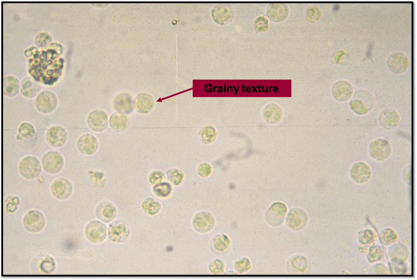 what causes white blood cells in dog urine