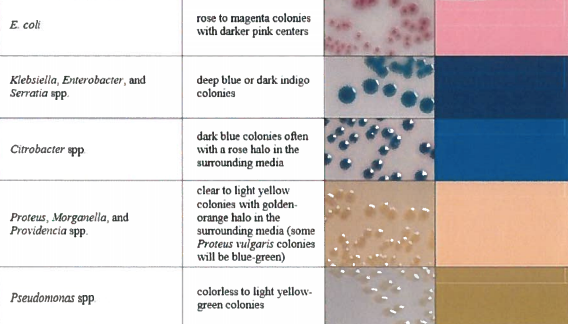 Table identifying bacteria based on the color on the HurBi plate