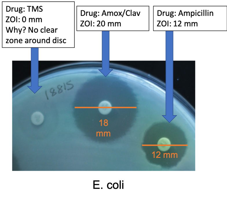 TMS drug has a ZOI of 0 mm (no clear zone around disk). Amox/Clav drug has ZOI of 20 mm. Ampicillin drug has ZOI of 12 mm.