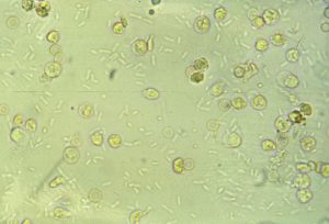 Module 8.4: Common Structures Observed on the Sediment Exam – Clinical ...