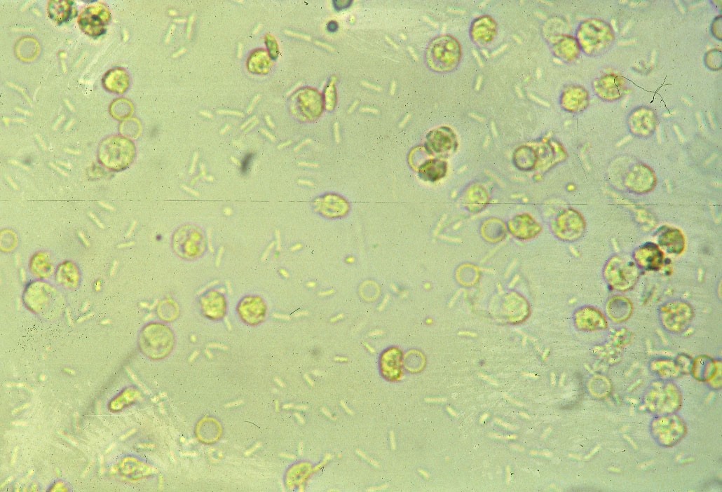 Urinary tract infection in a dog. Many rod-shaped bacteria (E. coli on culture) are seen free in the background with many WBCs and RBCs.