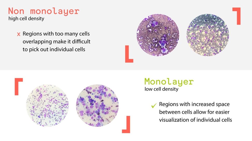 Locate the monolayer by looking for regions of low cell density.