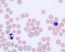 Module 7.2: Blood Smear Examples – Clinical Veterinary Diagnostic ...