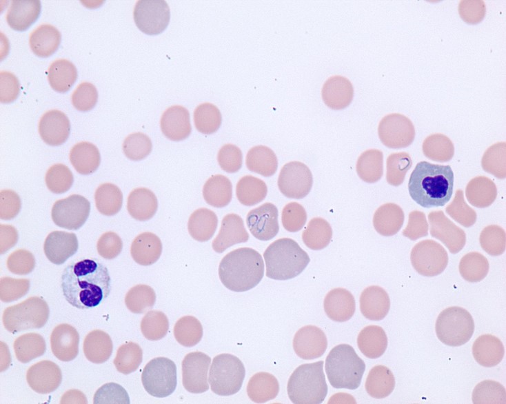 Large variant Babesia sp. in RBC of a canine blood smear (monolayer) at 100x