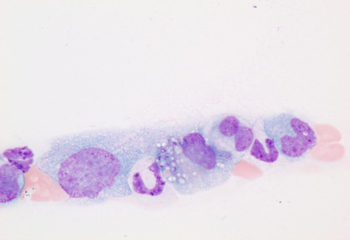 Histoplasma capsulatum in a monocyte on the feathered edge at 40x