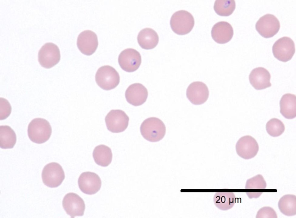 Cytauxzoon felis in feline RBC's in the monolayer at 100x