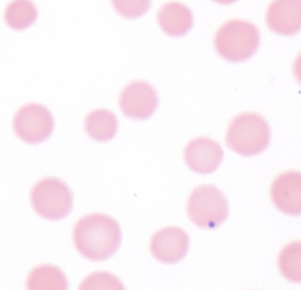 Anaplasma marginale in the RBC of a bovine blood smear (monolayer) at 100x.
