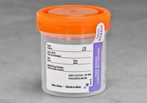 Sterile Urine Jar