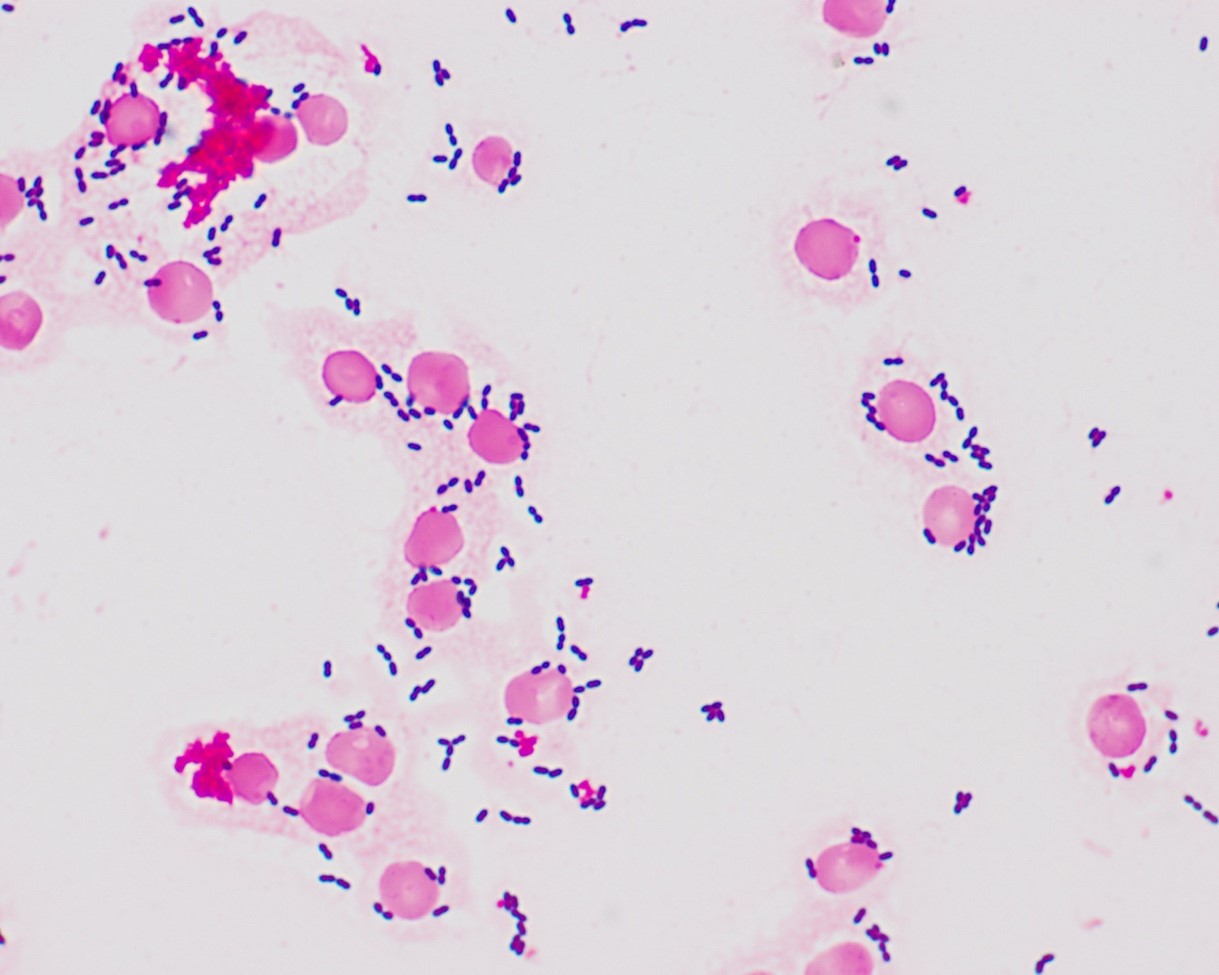 Canine blood smear that is stained with a Gram stain. In the image, you see many deep purple diplococci that are free and associated with RBCs (the large red circular structures). Note that the RBC pick up the Safranin counterstain. WBC will have similar staining feature EXCEPT the nuclei will stain Gram-positive. WBC nuclei make great internal controls. (100x)
