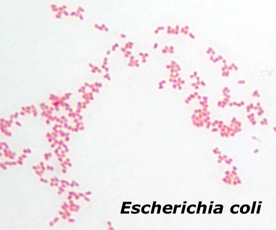 The image above is of E. coli bacteria harvested from a pure culture. In comparison to blood smear above, you can see the pale red appearance of the Gram-negative bacteria in this image. (100x)
