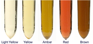 Urine color scale ranging from light yellow to brown