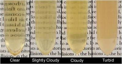 Urine turbidity scale ranging from clear to turbid