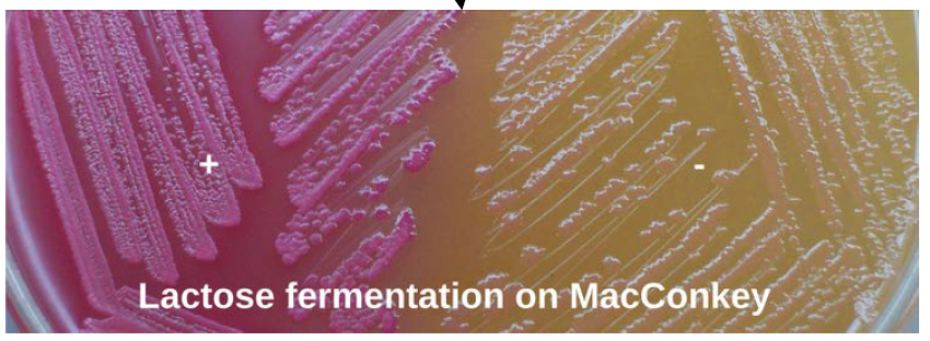 Lactose fermentation on MacConkey Plate