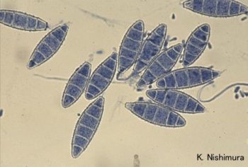 Module 13.3: Three Most Common Veterinary Dermatophytes Observed on DTM ...