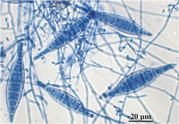 Module 13.3: Three Most Common Veterinary Dermatophytes Observed on DTM ...