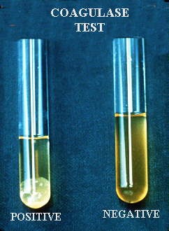 Coagulase test, positive has a clot, negative has no clot