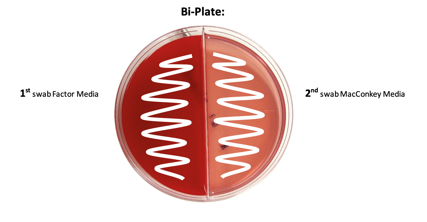 Bi-Plate Procedure: 1st swab Factor Media, 2nd swab MacConkey Media