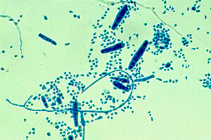 Module 13.3: Three Most Common Veterinary Dermatophytes Observed on DTM ...