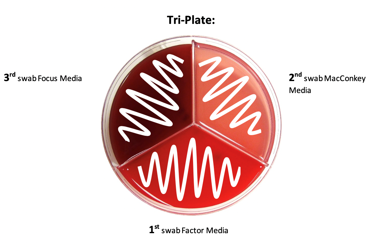 Tri-Plate Procedure: 1st swab Factor Media, 2nd swab MacConkey Media, 3rd swab Focus Media
