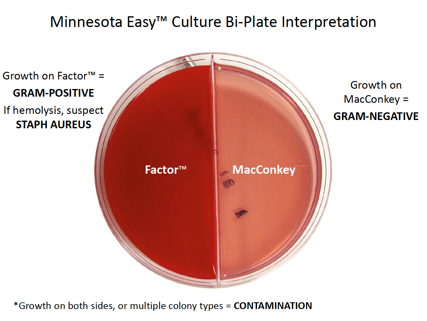 Bi-Plate Interpretation: Growth on Factor=Gram+. Growth on MacConkey=Gram-. Growth on both sides=contamination