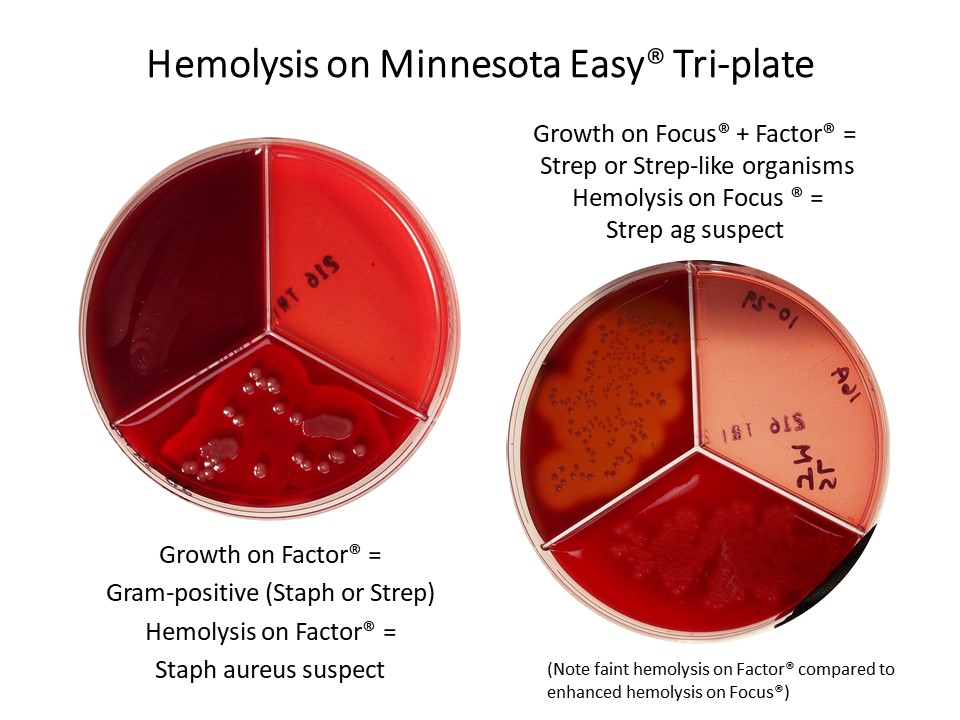 Hemolysis patterns on Minnesota Easy® Tri-Plate: Growth on Factor=Gram+ (staph or Strep), hemolysis on Factor=Staph aureus suspect. Growth on Focus+Factor=Strep or Strep=like organisms, Hemolysis on Focus=Strep ag suspect