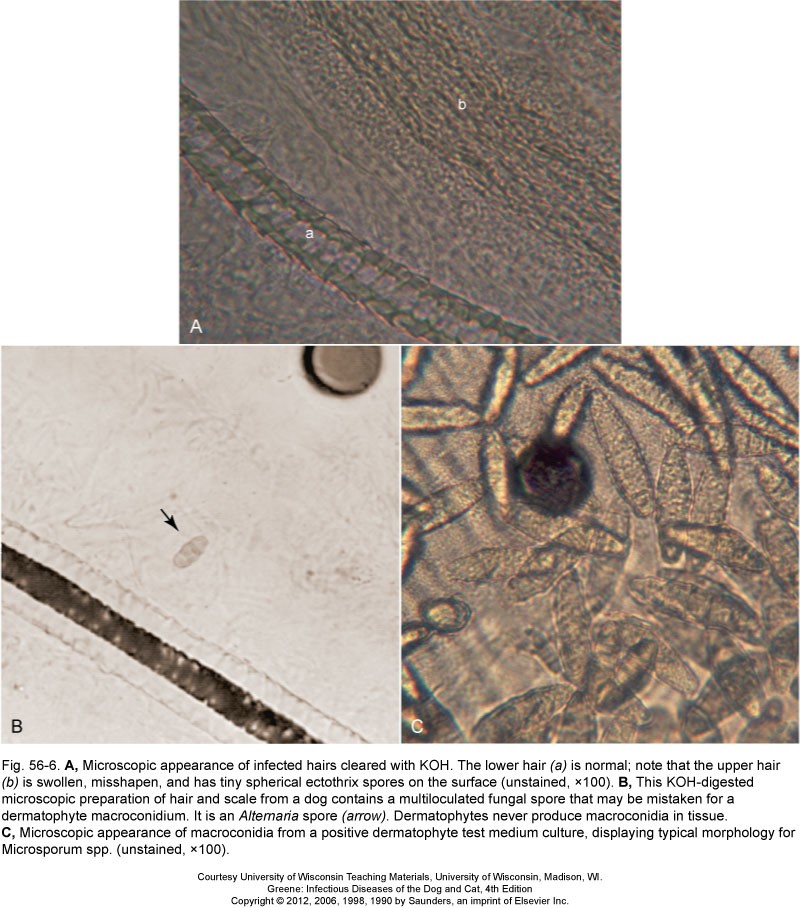 Above is an image that identifies what a normal hair (A) and an infected hair (B) with dermatophyte arthrospores looks like. Image (C) is an unstained macroconidium taken from culture (DTM). This form would not be found on hair, only on culture (DTM).