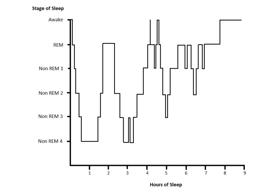 Hypnogram of hours of sleep on x axis and stages of sleep on y axis