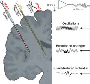 A cross section of the brain showing three different kinds of electrodes implanted (ECoG, DBS, SEEG) and three different possible kinds of recordings (oscillations, broadband changes, event-related potentials)