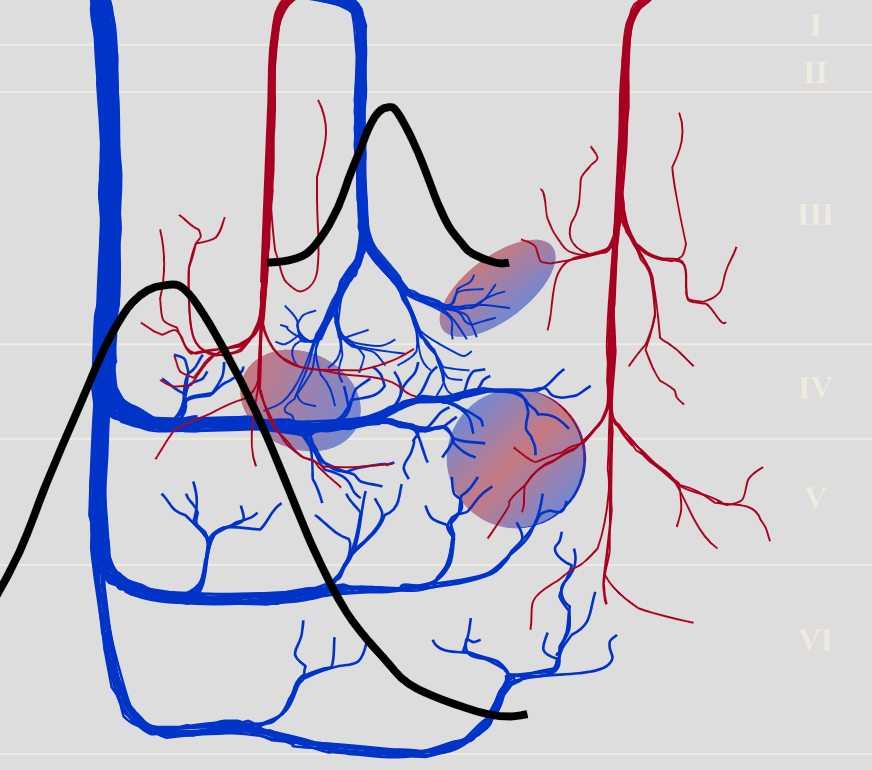 Diagram showing how vein size can impact signal detection in fMRI.