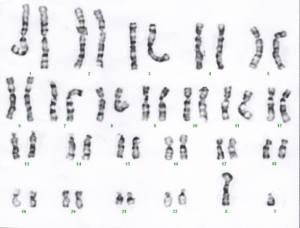 Micrograph of condensed chromosomes