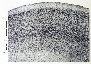 A cross section of the rain showing different densities of staining at different depths and striations running perpendicular to the cortical surface