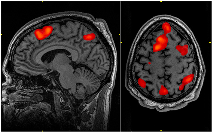 An example of an fMRI head scan is shown.