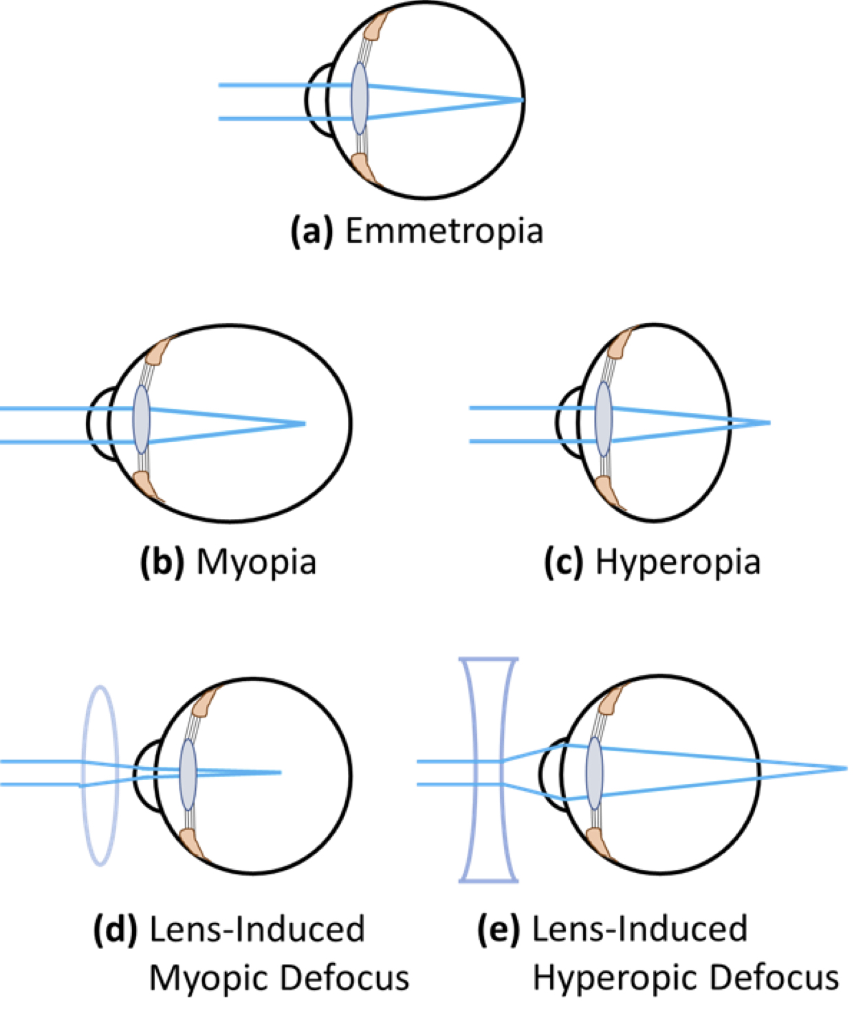 Near and Farsighted Eyes Introduction to Sensation and Perception