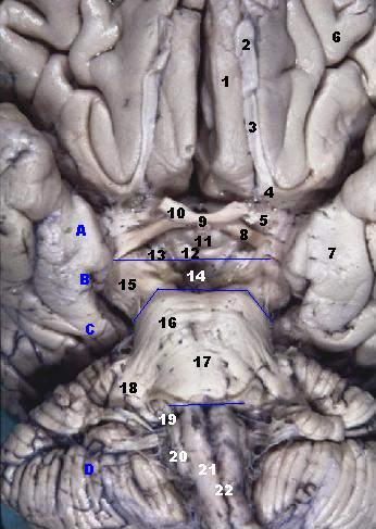 A labeled view of the brain is shown. Each number corresponds with a section of the brain above. The caption lists all of the labeled parts.