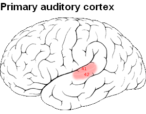 The primary auditory cortex is highlighted in the temporal lob of the brain.