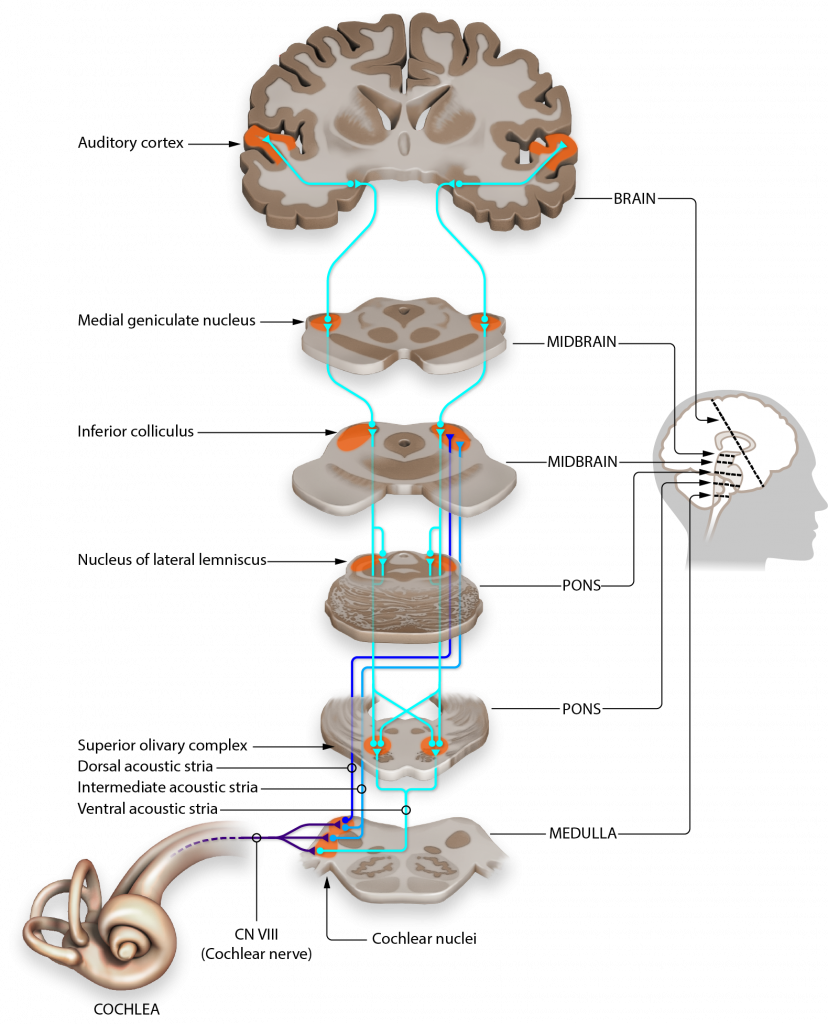 The image shows the pathway from the cochlea to the auditory cortex through the brain.