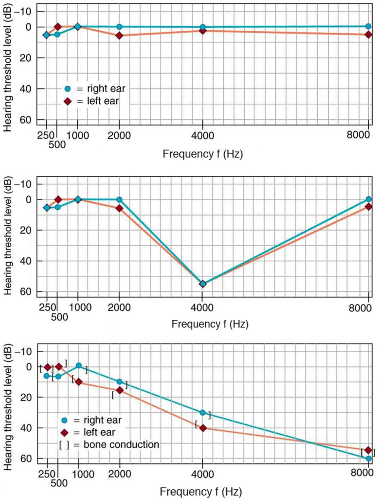 Three graphs are shown. They all range from -10 to 60 decibels and from 250 to 8000 Hz.