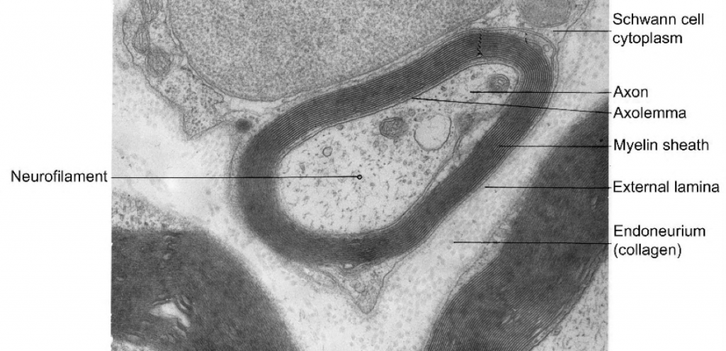 Gray-scale image showing cell parts. In the middle is a squished set of tight rings, which is a cross section of the myelin sheath on an axon.