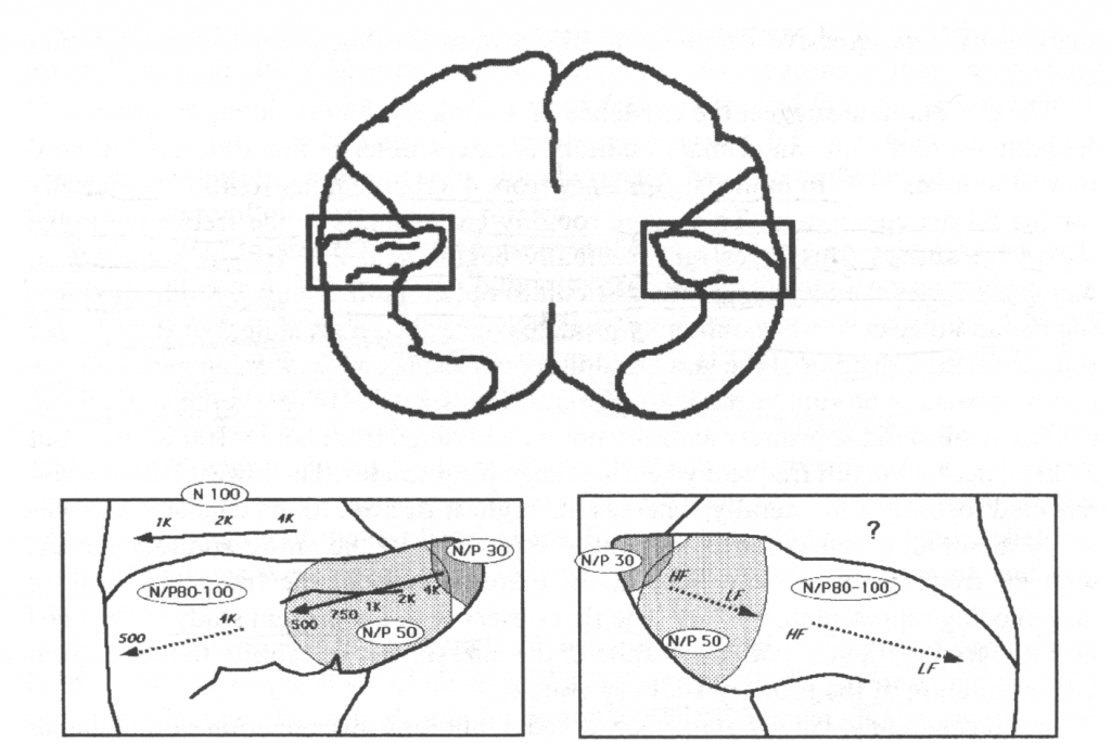 This image highlights that there is a primary auditory cortex on both the left and right hemispheres.