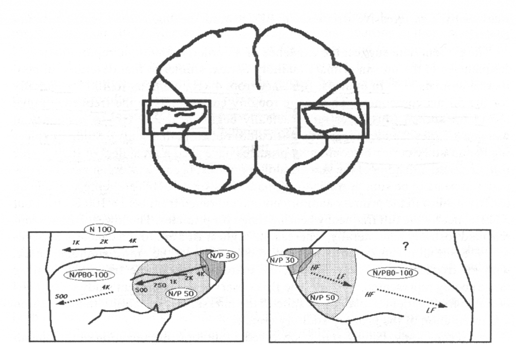 This image highlights that there is a primary auditory cortex on both the left and right hemispheres. 