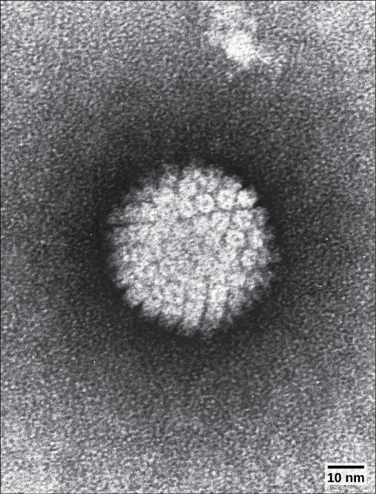 The micrograph shows an icosahedral virus with glycoproteins protruding from its capsid.