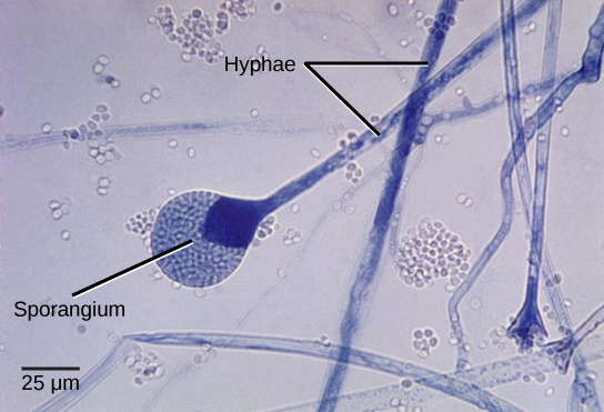 Micrograph shows several long, thread-like hyphae stained blue. One hypha has a round sporangium, about 35 microns in diameter, at the tip. The sporangium is dark blue at the neck, and grainy white and blue elsewhere. Spores that have already been released appear as small white ovals.
