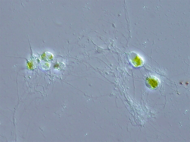 Image is a Chlorarachniophyte. It appears as a series of green cells with what appear to be fibers surrounding and connecting them.