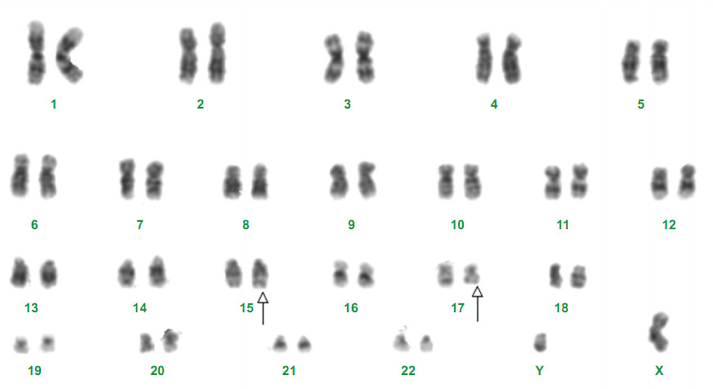 Micrograph of condensed chromosomes