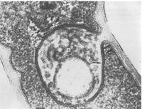 Corynebacterium diphtheriae